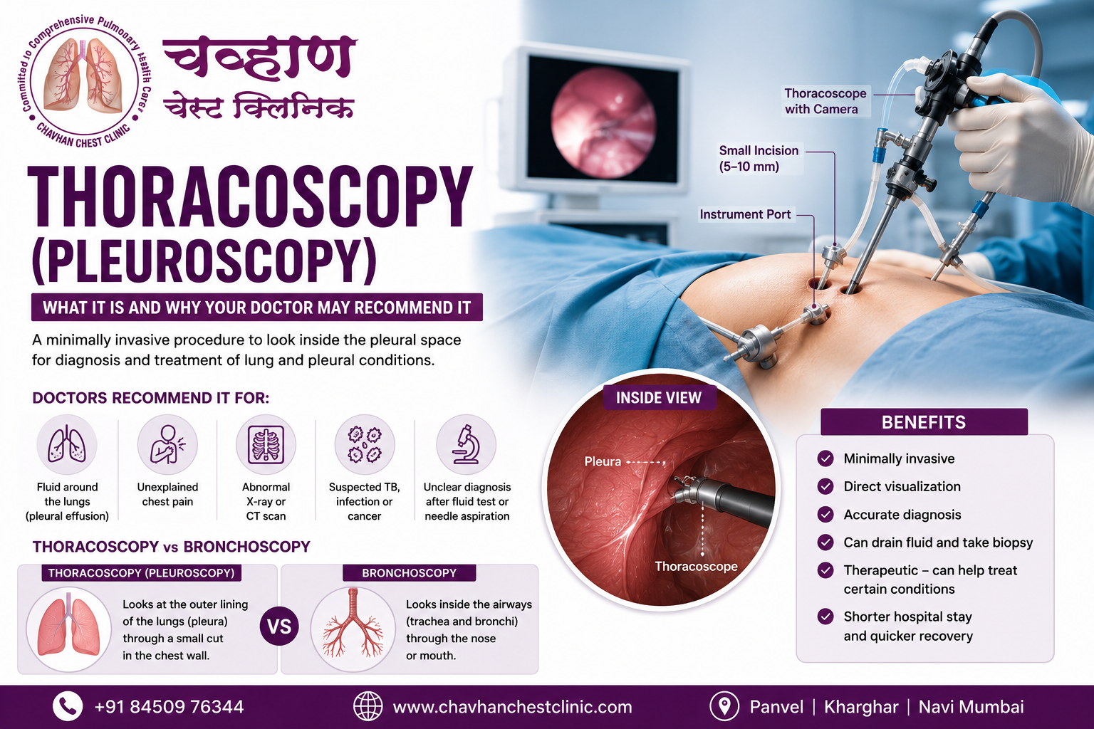Thoracoscopy (pleuroscopy) procedure showing minimally invasive examination of the pleural cavity for pleural biopsy, lung fluid drainage, and diagnosis of pleural diseases.