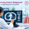 Lung nodule and lung cancer diagnosis using CT scan
